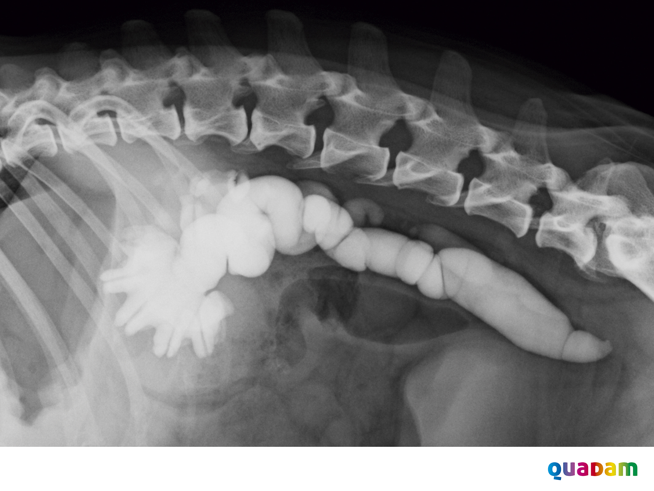 Curso de radiología abdominal